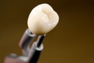 Dental Crowns: 5 Reasons Why You Need Them